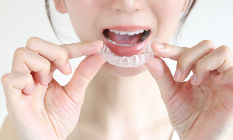 アライナー矯正